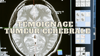 Témoignage : tumeur du cerveau